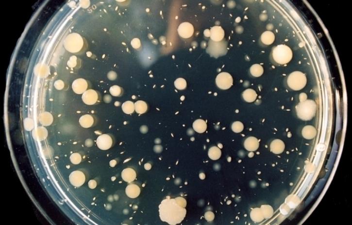 Petrischale mit Mikroorganismen