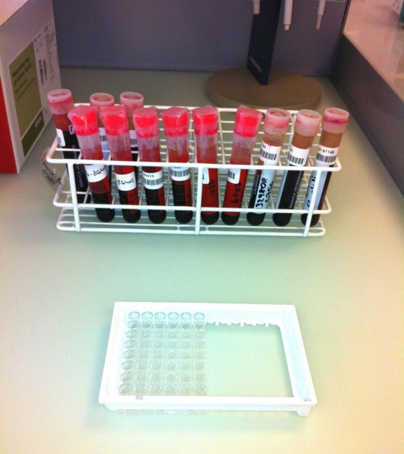 la photo représente des tubes de sang prêts pour l'analyse