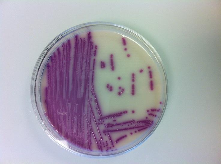 Das Bild zeigt eine Petrischale mit einer Kultur von Salmonella spp