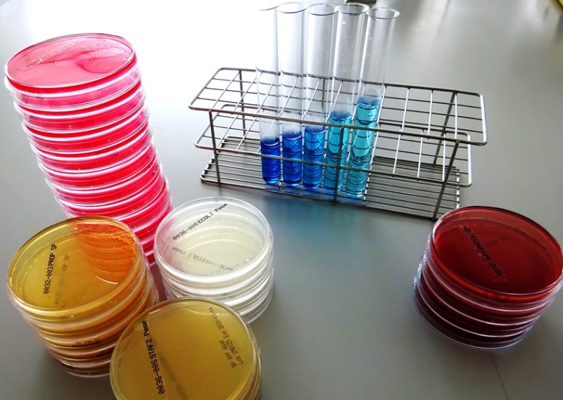 Das Bild zeigt Laborutensilien